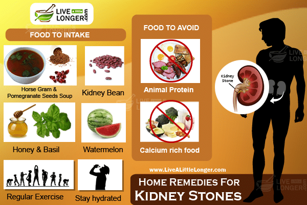 kidney stones home remedies