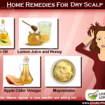Home remedies for dry scalp
