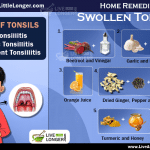 Home remedies for swollen tonsils