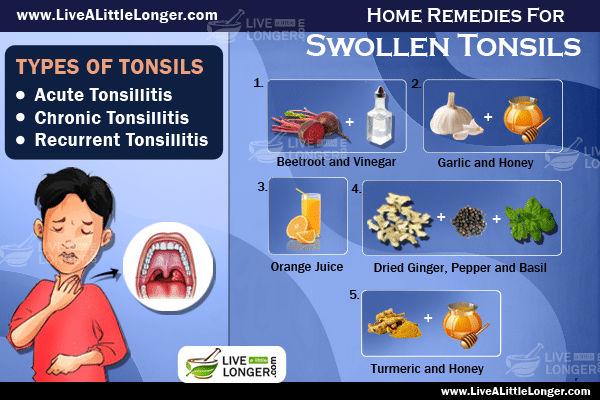 Natural Ways To Cure Swollen Tonsils Live A Little Longer