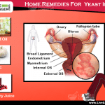 home remedies for yeast infections
