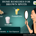 Home remedies for brown spots