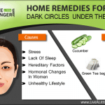 Home remedies for dark circles under the eyes