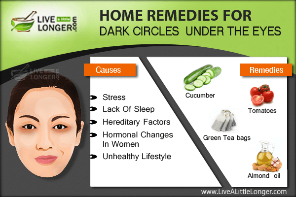 Home remedies for dark circles under the eyes