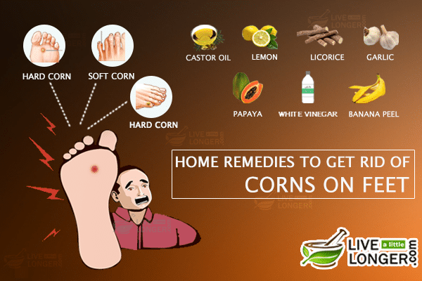 Home remedies for corn on feet