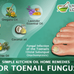 home remedies for toe nail fungus