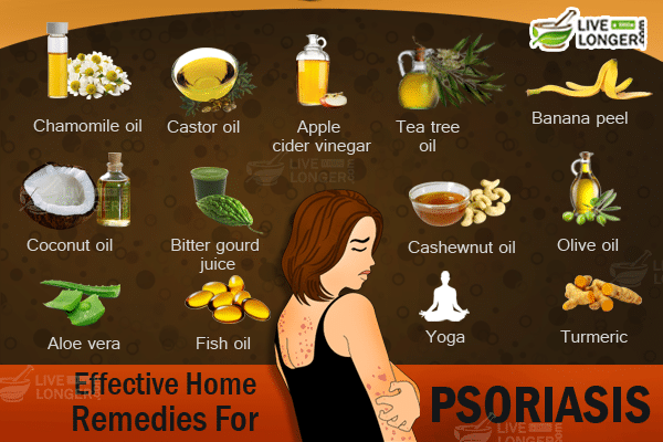 Home remedies for psoriasis