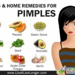 how to get rid of pimples fast