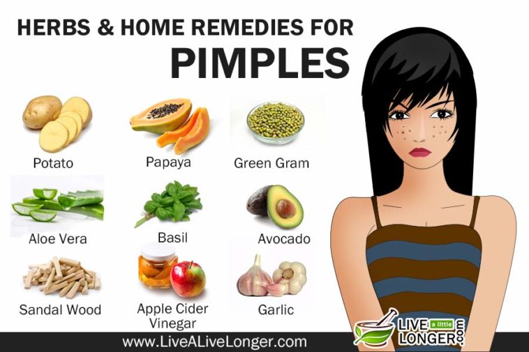 How To Get Rid Of Pimples Try These Effective Home Remedies