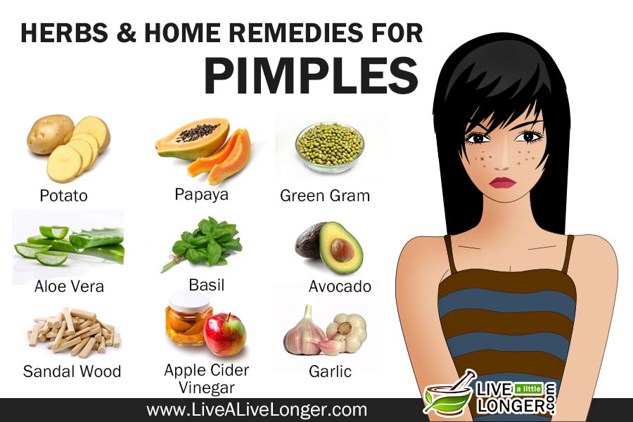 Best Home Remedies For Pimples