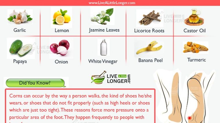 home remedies for corns on feet