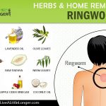 home remedies for ringworms