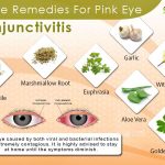 Home Remedies For Pink Eye