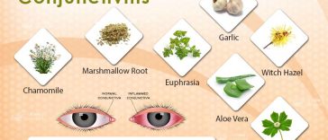 Home Remedies For Pink Eye