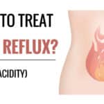 home remedies for acid reflux