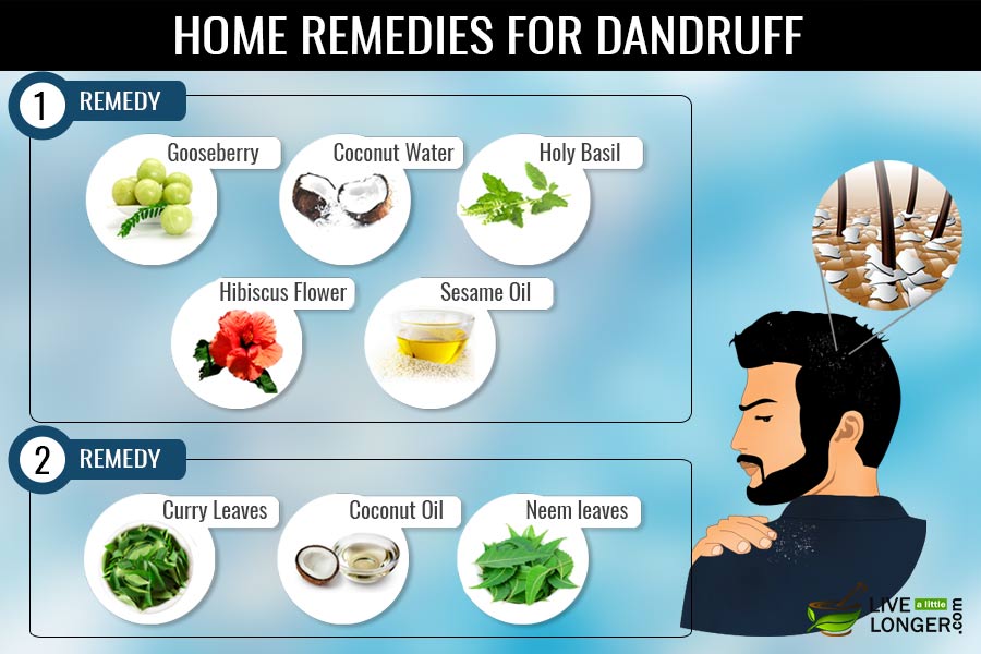 home remedies for dandruff