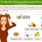 how to get rid of dandruff