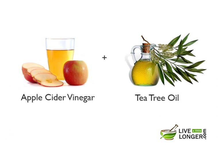 How To Get Rid Of Dandruff Fast And Permanently?