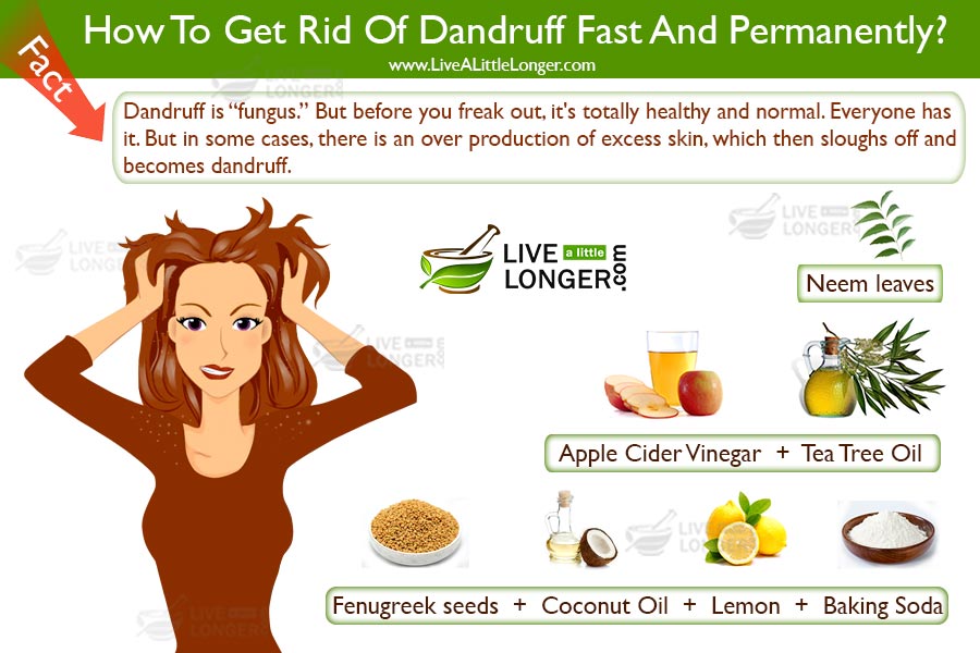 how to get rid of dandruff