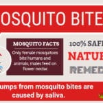 Home Remedies For Mosquito Bites