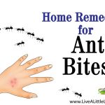 Home Remedies For Ant Bites