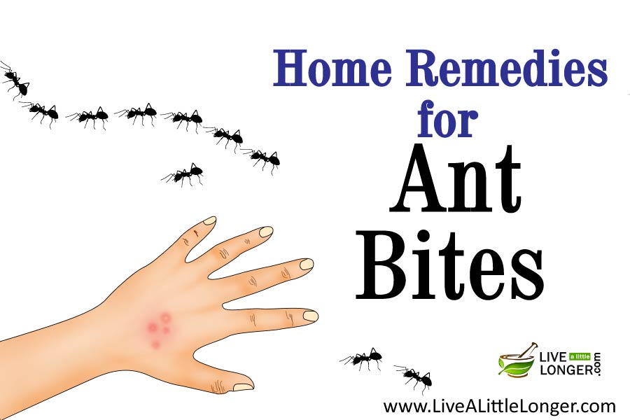 Home Remedies For Ant Bites