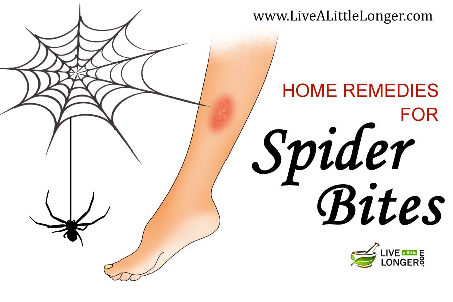 best treatment for spider bites