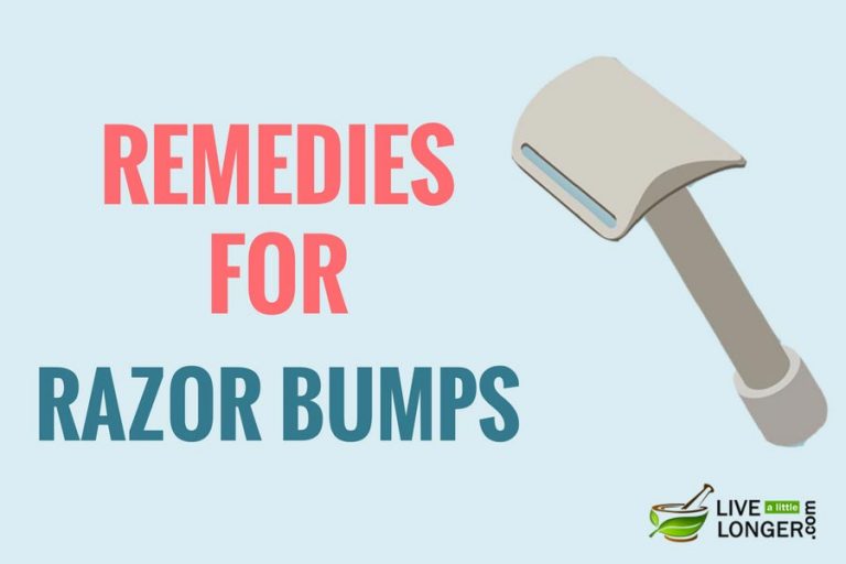 How To Get Rid Of Razor Bumps Fast? 10 Remedies That Help
