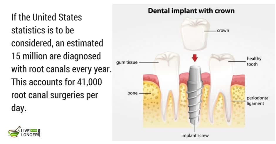 most common teeth problems