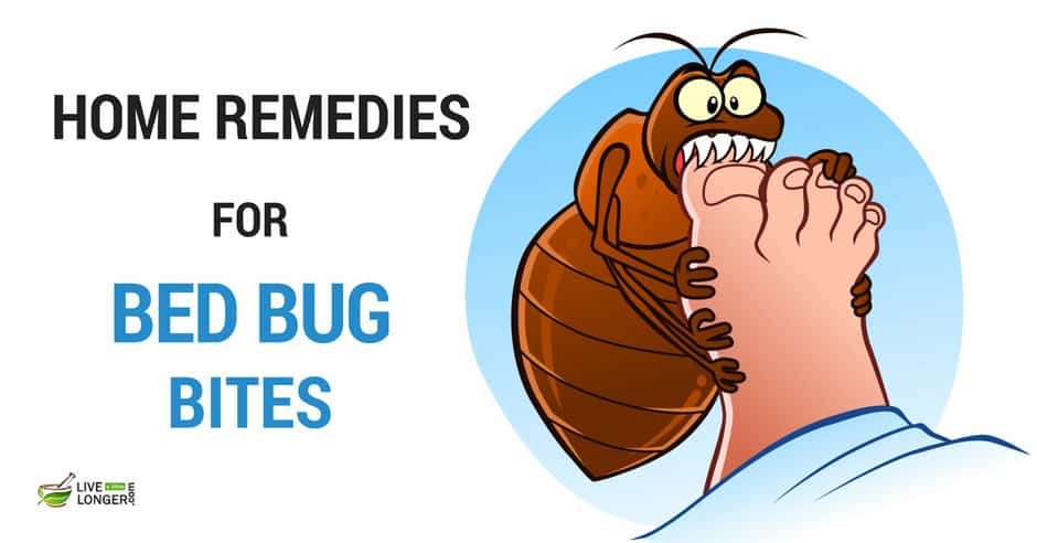 Home Remedies For Bed Bugs