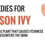 Home Remedies For Poison Ivy