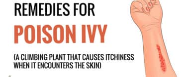 Home Remedies For Poison Ivy