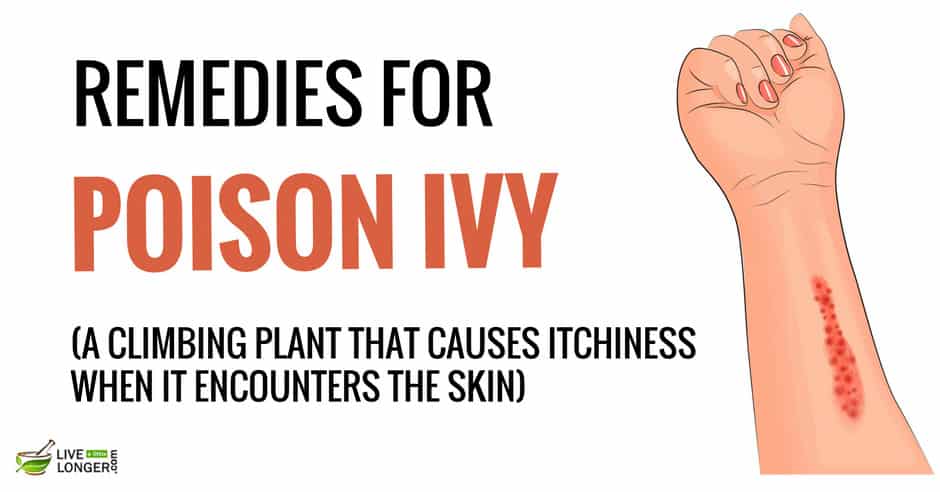 Home Remedies For Poison Ivy