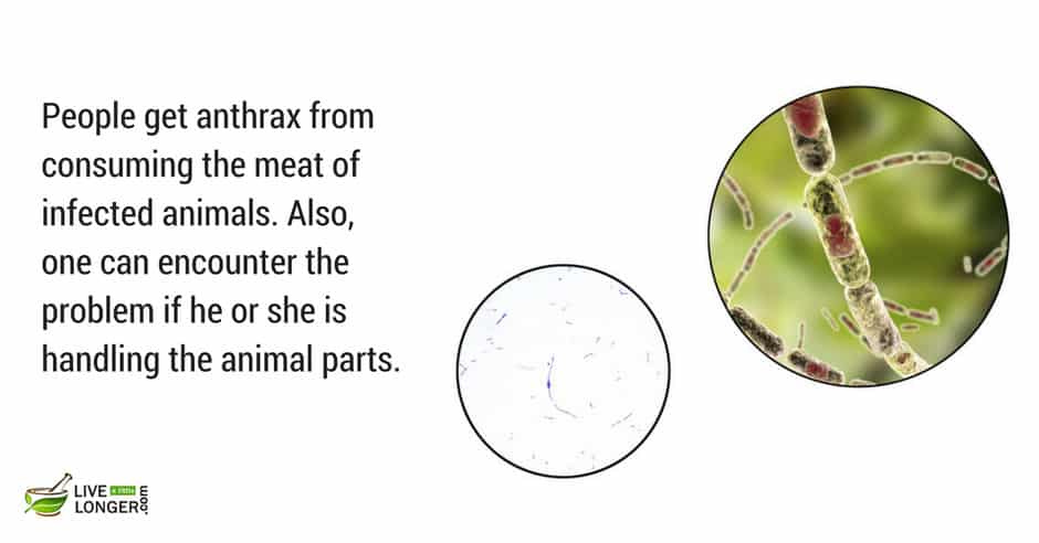 anthrax is a rare deadly disease most common diseases