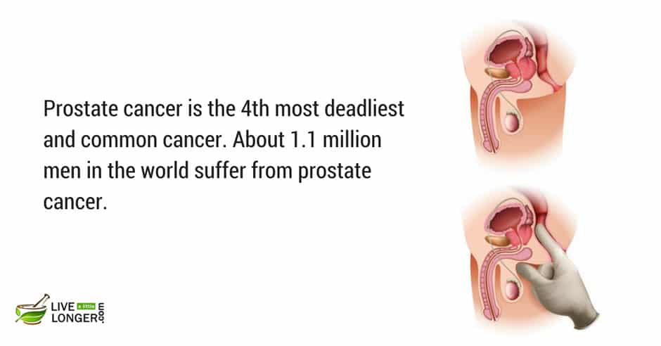 most common cancers deadliest cancer
