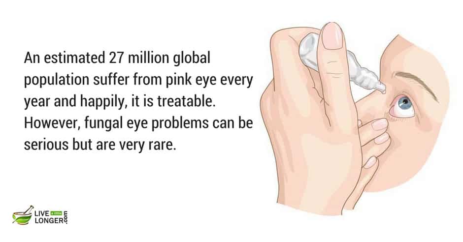 eye pain is a common illness Most Common Diseases