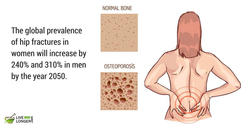 common bone diseases