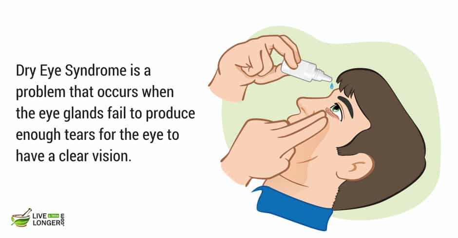 dry eyes is a common eye problem