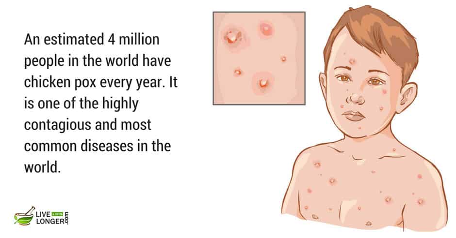 deadliest infectious diseases