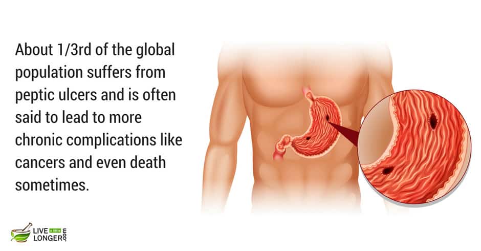 common ulcers in humans