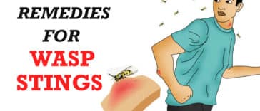 Home Remedies for Wasp Stings