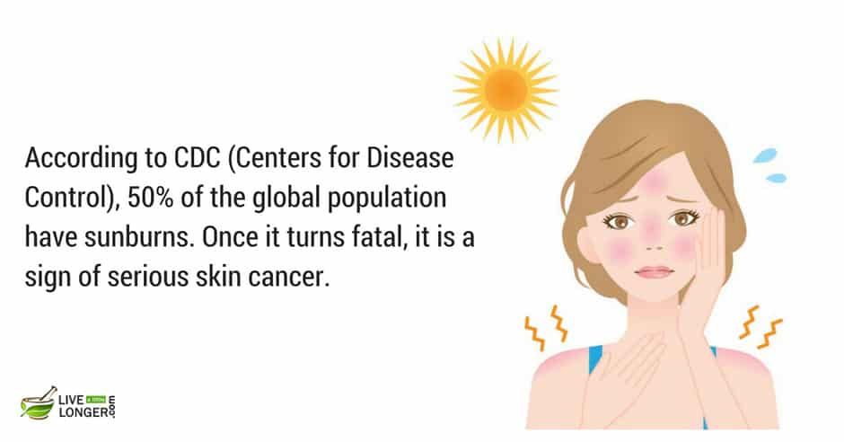 most common skin diseases most common skin diseases