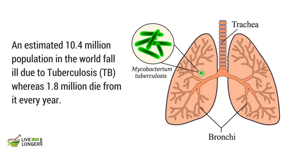 most common lung diseases most common lung diseases