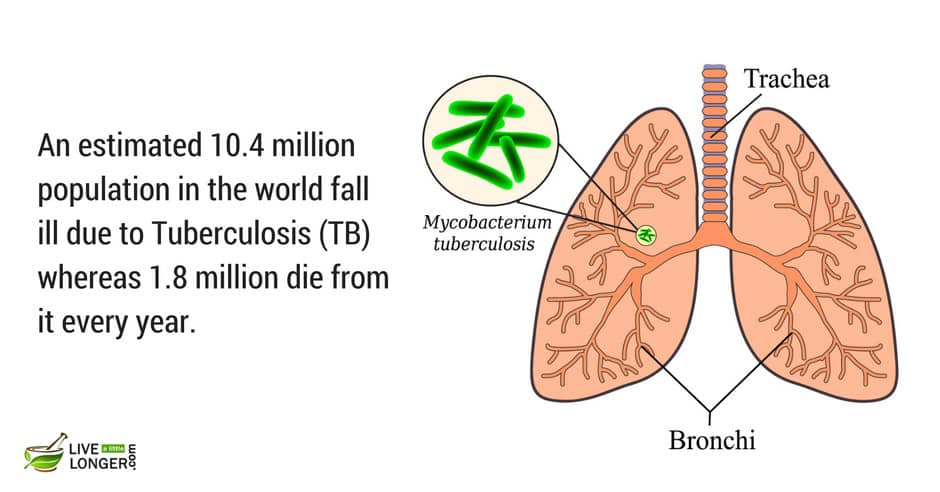 most common lung diseases