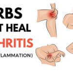 Home Remedies For Arthritis