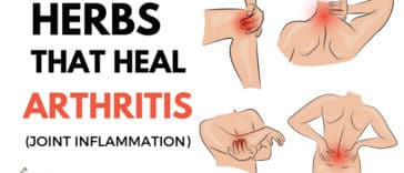 Home Remedies For Arthritis