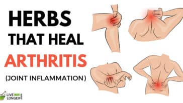 Home Remedies For Arthritis