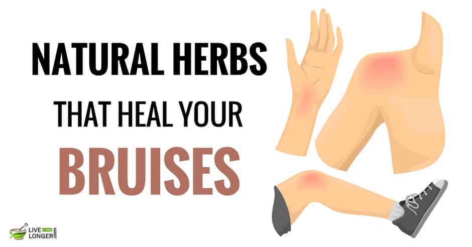 natural remedies for bruises