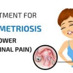 Remedies For Endometriosis
