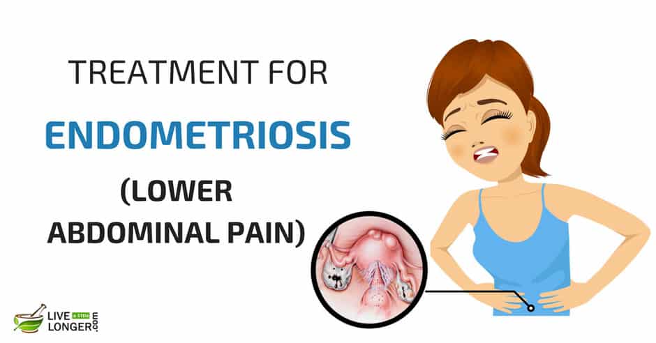 Remedies For Endometriosis